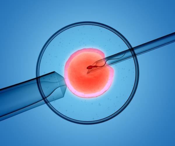 An image of IVF