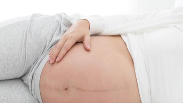 什么是黑线——我怀孕的肚子上的黑线?