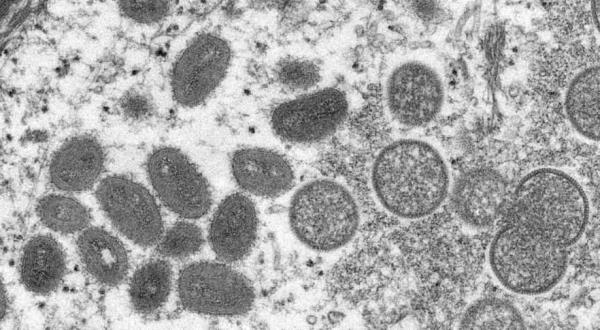 专家对迅速传播的与猴痘病毒有关的错误信息表示担忧
